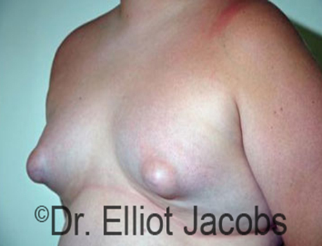 carol scheffler like puffy nipples beach photo brenton mills recommends puffy nipples beach pic