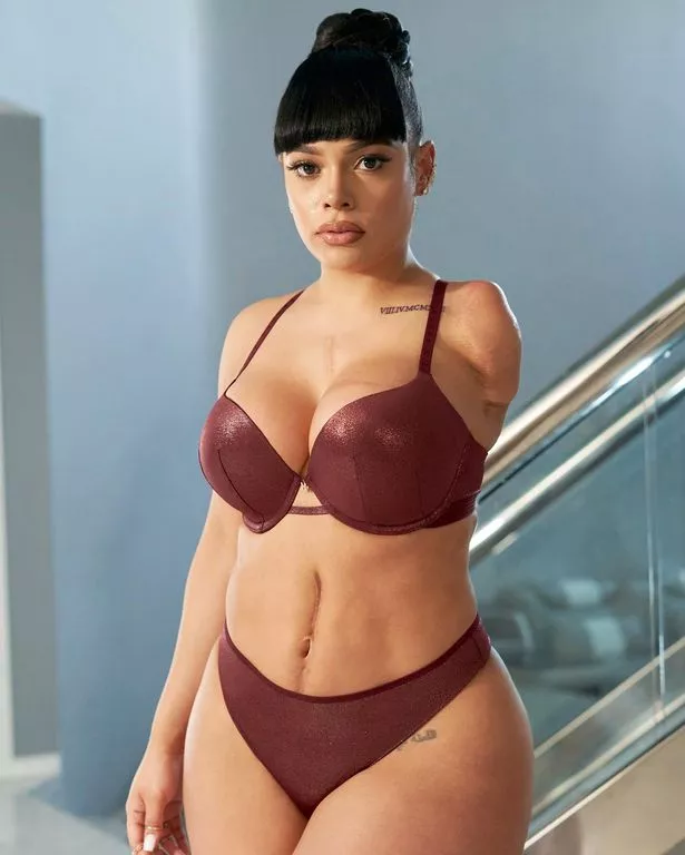 cj mosher recommends amputee sex pic