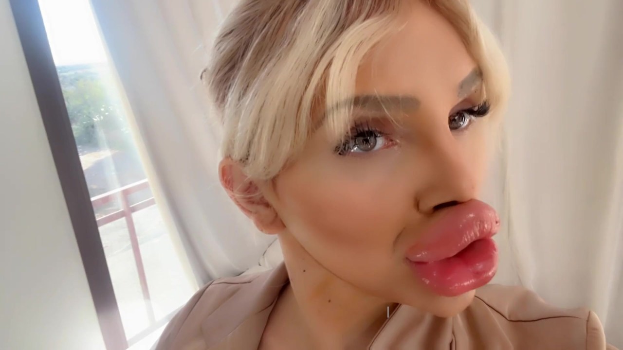 beverly bland recommends big lips porn pic