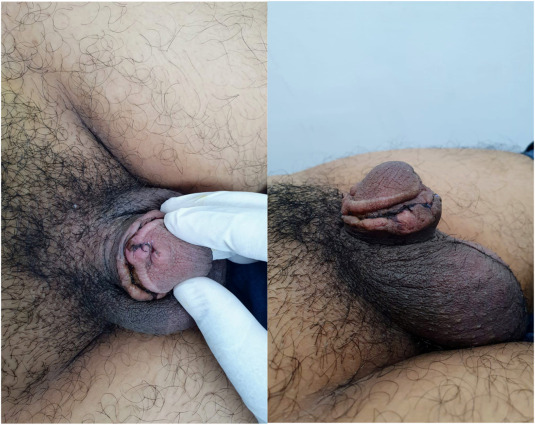 christopher bigley add photo cock holes