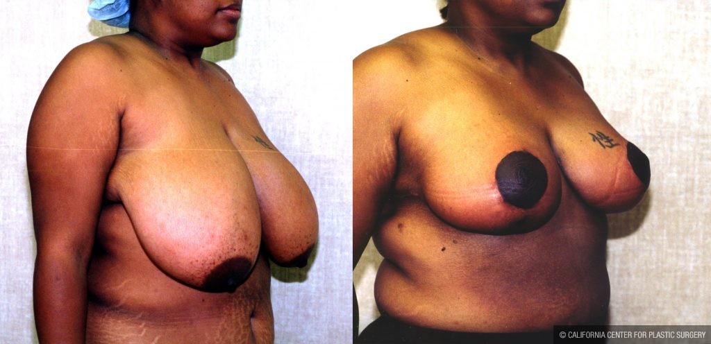 Best of Saggy big titts
